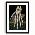 Dark Academia Wall Art - Gothic Skeleton Hand for Moody Aesthetic Decor