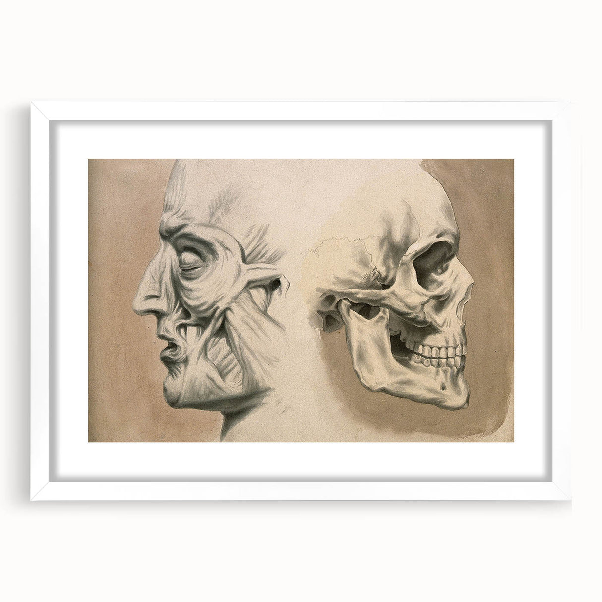 Grunge Aesthetic Art: Vintage Skull & Anatomy Grunge Wall Art on Canvas
